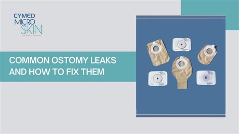 Understanding and Managing Leaking Ostomy Bags: Causes,。